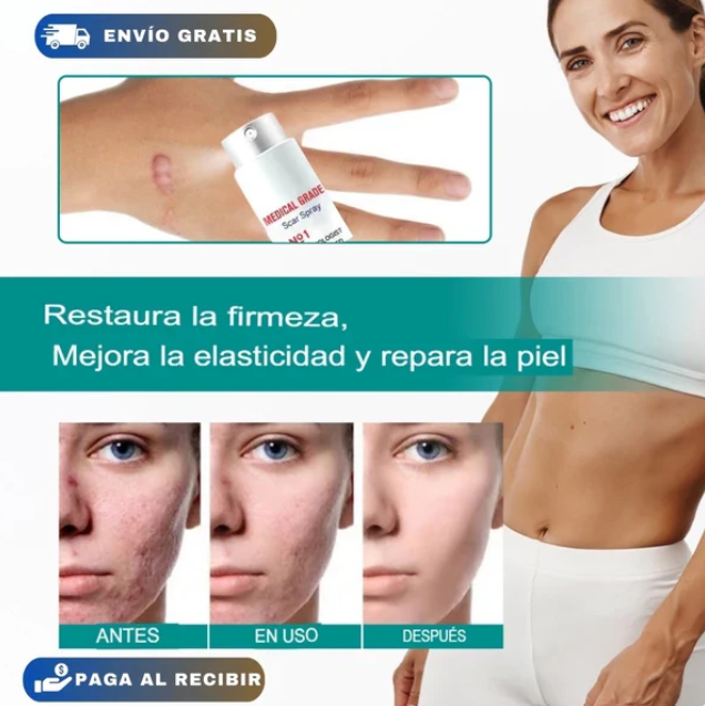 MarcRemove™ Elimina cicatrices y revitaliza tu piel